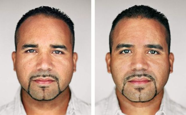 Différences entre les jumeaux - 10