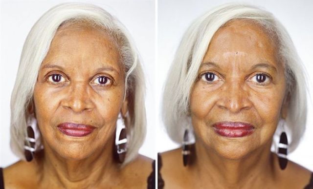 Différences entre les jumeaux - 12