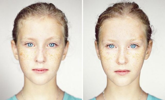 Différences entre les jumeaux - 15