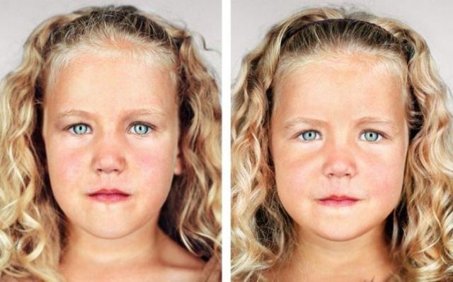 Différences entre les jumeaux - 2