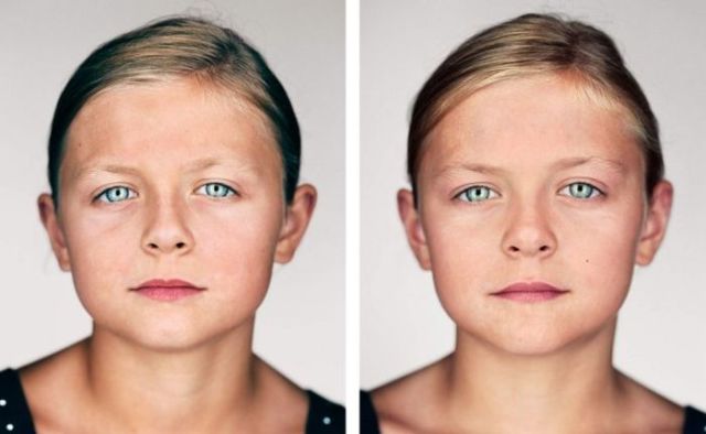 Différences entre les jumeaux - 4