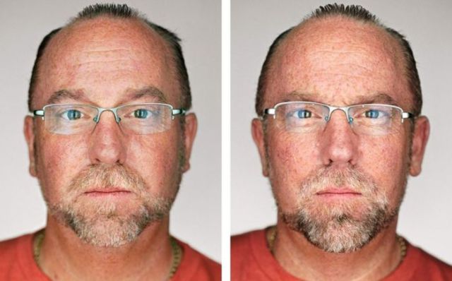 Différences entre les jumeaux - 5