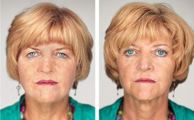 Différences entre les jumeaux - 8