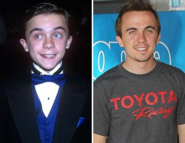 Les enfants stars maintenant (Frankie Muniz 2000 et maintenant)
