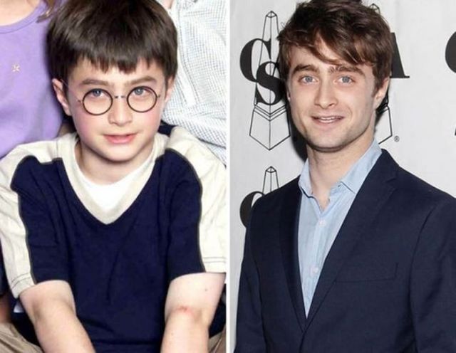 Les enfants stars maintenant (Daniel Radcliffe 2000 et maintenant)