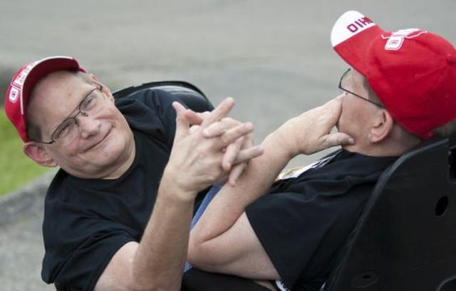 Des frères siamois - 2