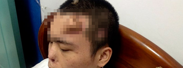 Cet homme a nez qui pousse sur le front !