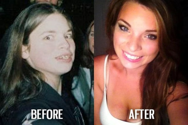 Ces filles sont devenues canon