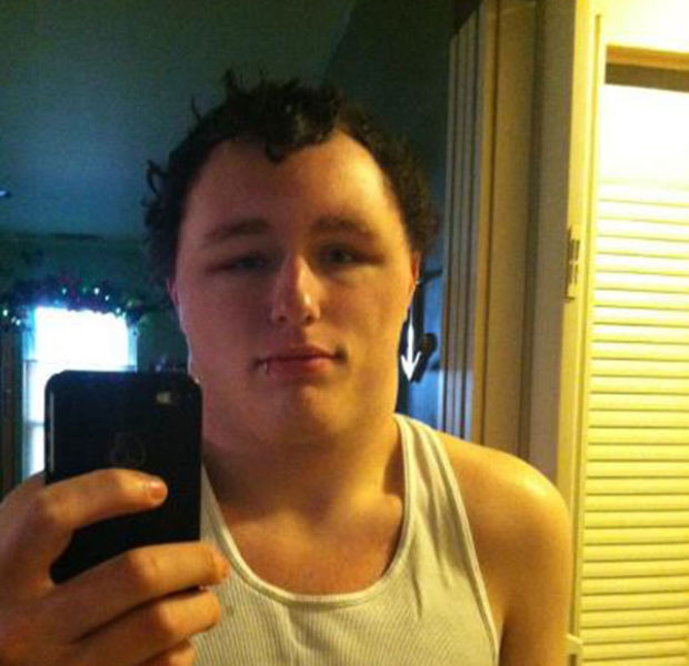 Visages gonfls piqre - 5