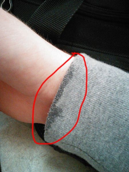 trucs qui gonflent - 9