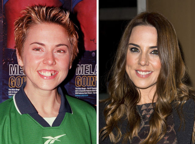 La dentition parfaite des stars - 10