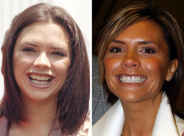 La dentition parfaite des stars - 12