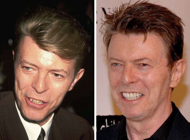 La dentition parfaite des stars - 13