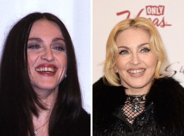 La dentition parfaite des stars - 15