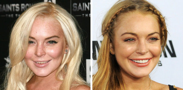 La dentition parfaite des stars - 3