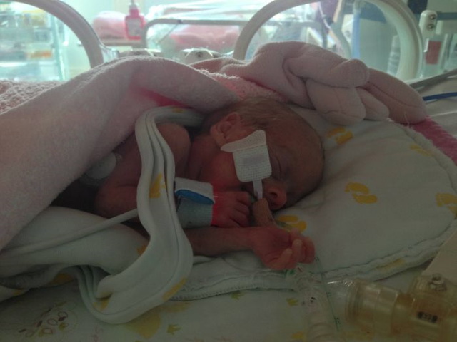 Photos d'un bb prmatur - 10