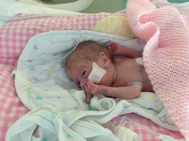 Photos d'un bb prmatur - 12