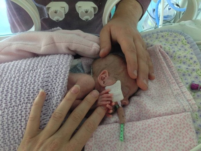 Photos d'un bb prmatur - 13