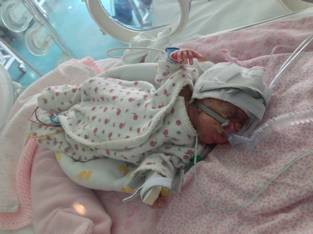 Photos d'un bb prmatur - 14