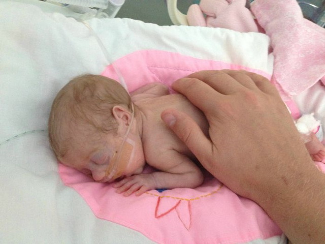 Photos d'un bb prmatur - 18