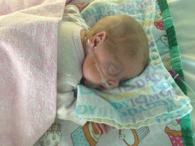 Photos d'un bb prmatur - 19