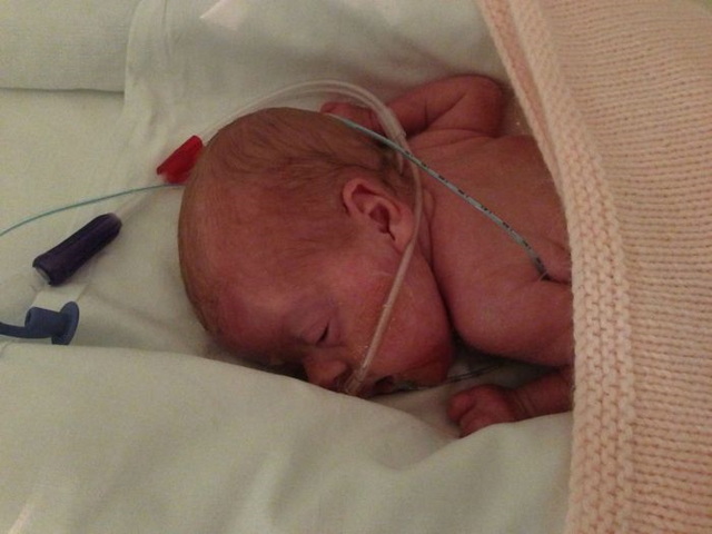Photos d'un bb prmatur - 22