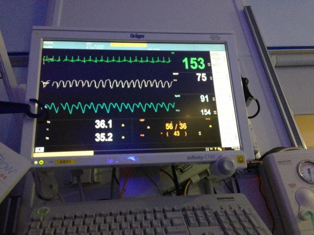 Photos d'un bb prmatur - 3