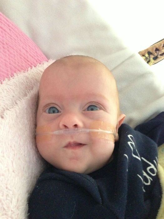 Photos d'un bb prmatur - 35