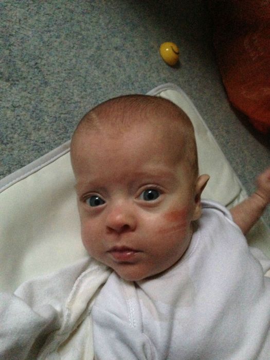 Photos d'un bb prmatur - 36