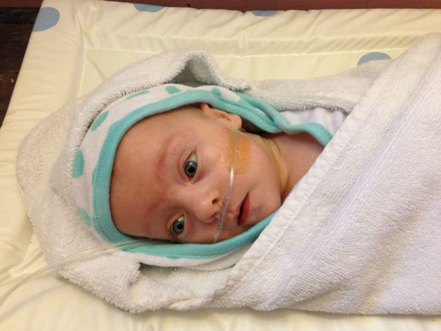 Photos d'un bb prmatur - 40