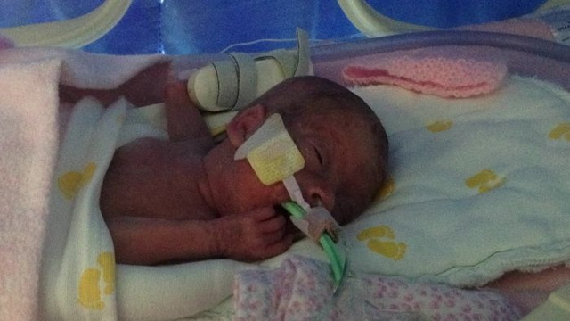 Photos d'un bb prmatur - 5
