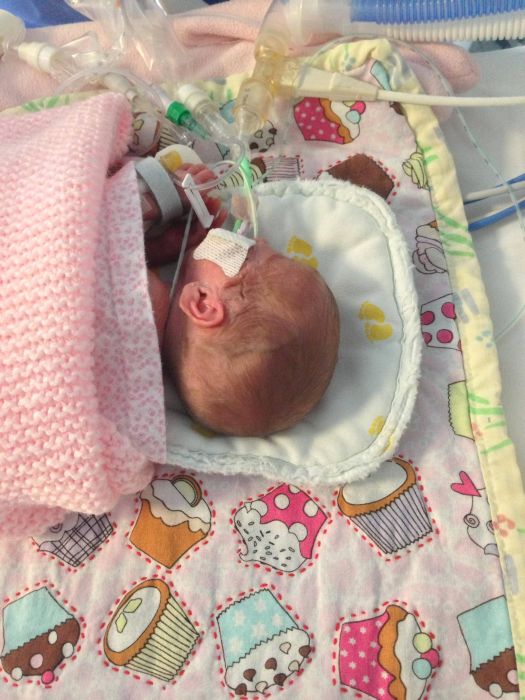 Photos d'un bb prmatur - 7