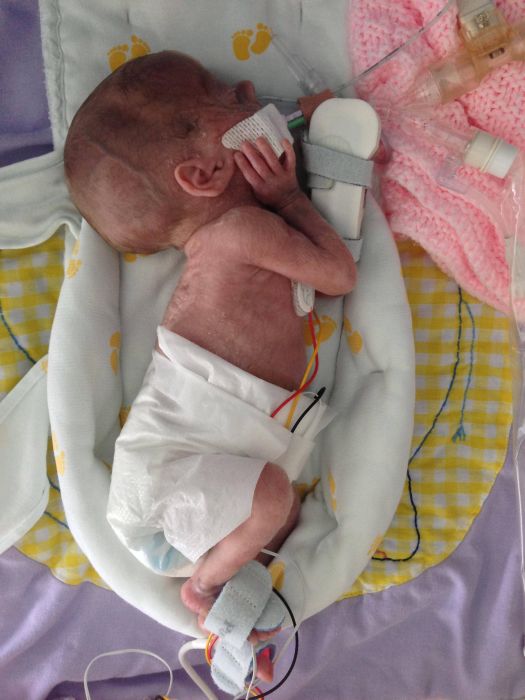 Photos d'un bb prmatur - 9