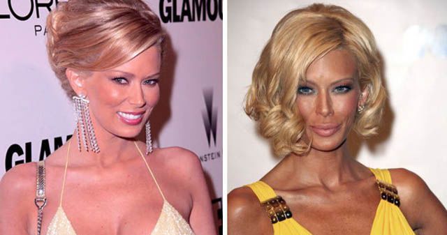 La chirurgie esthtique est dangereuse - 10