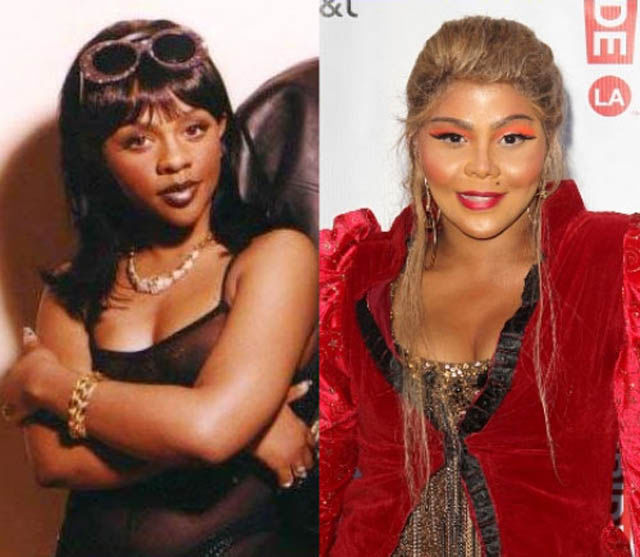 La chirurgie esthtique est dangereuse - 16