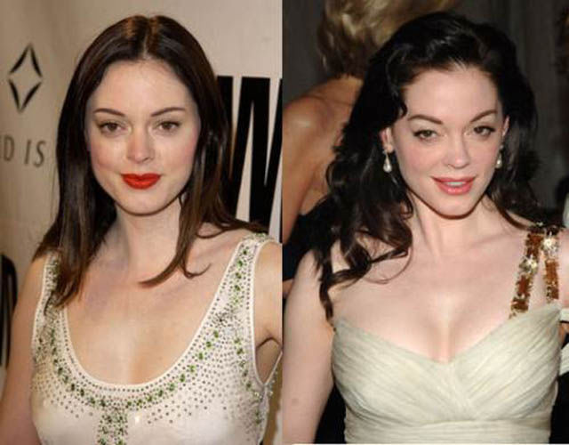 La chirurgie esthtique est dangereuse - 17