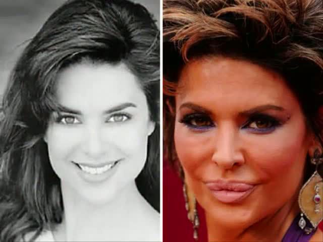 La chirurgie esthtique est dangereuse - 5