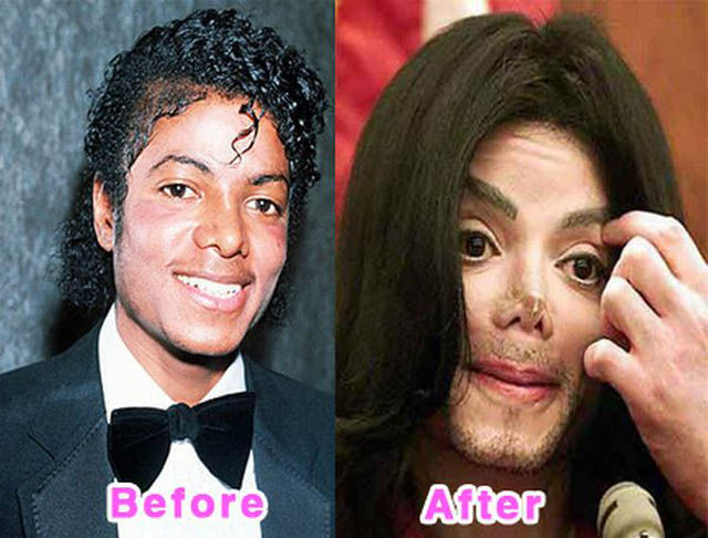 La chirurgie esthtique est dangereuse - 9