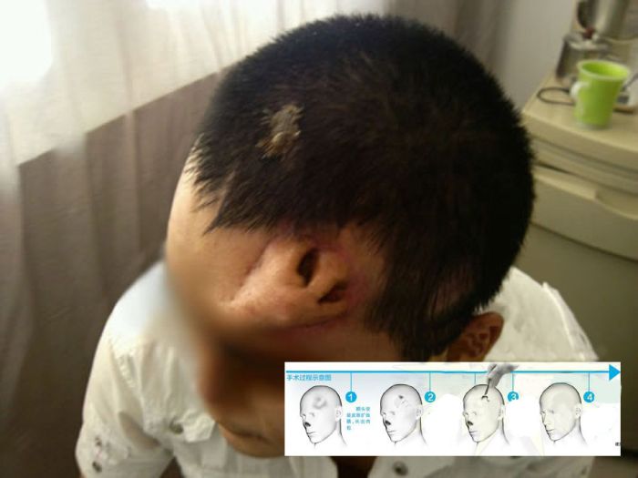 Un nez sur le front - 3